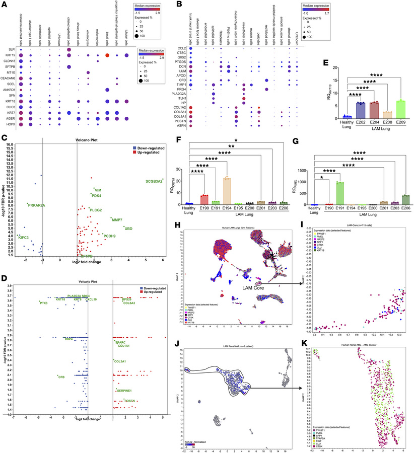 Neurocristopathic markers of LAM pulmonary neoplasms.
(A and B) Median e...