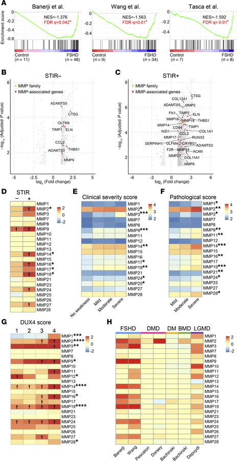 Elevated MMP and MMP-associated genes in FSHD patient biopsies.
(A) GSEA...