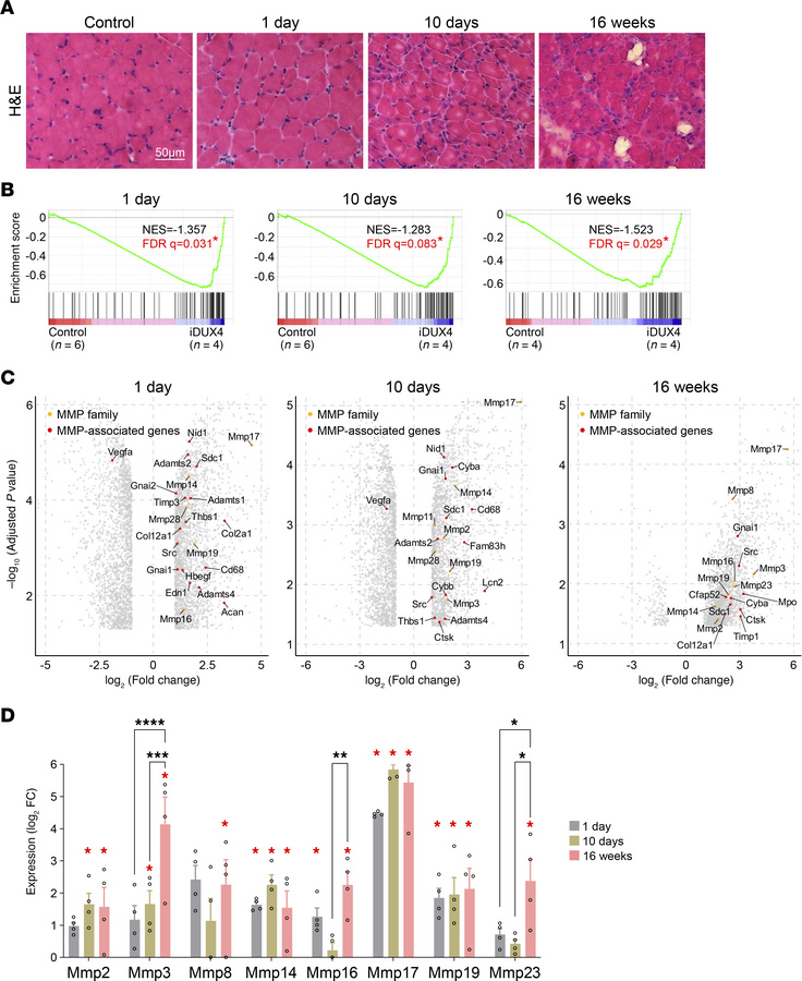 MMP expression correlates with disease stage in iDUX4 mice.
(A) Represen...