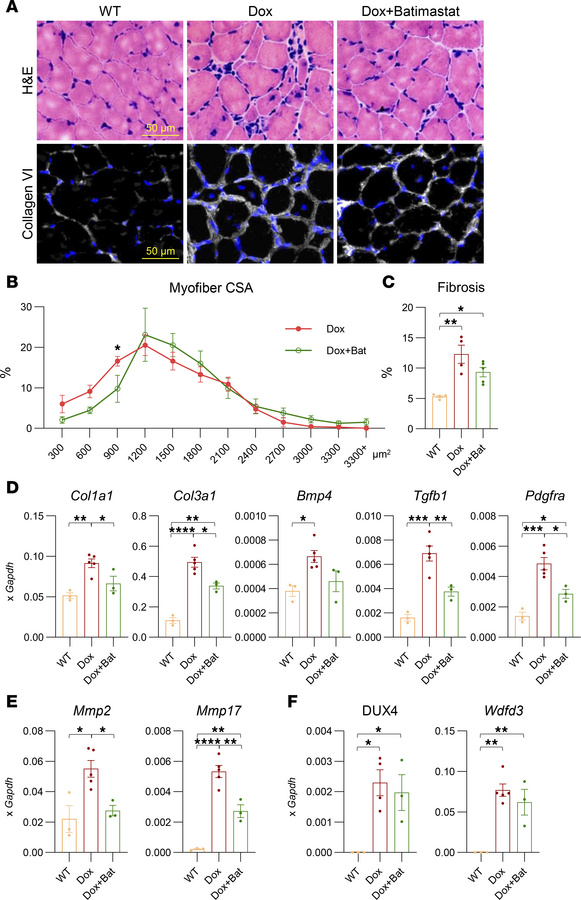 Batimastat treatment improves muscle phenotypes in iDUX4 mice.
(A) H&amp...