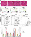 MMP expression correlates with disease stage in iDUX4 mice.