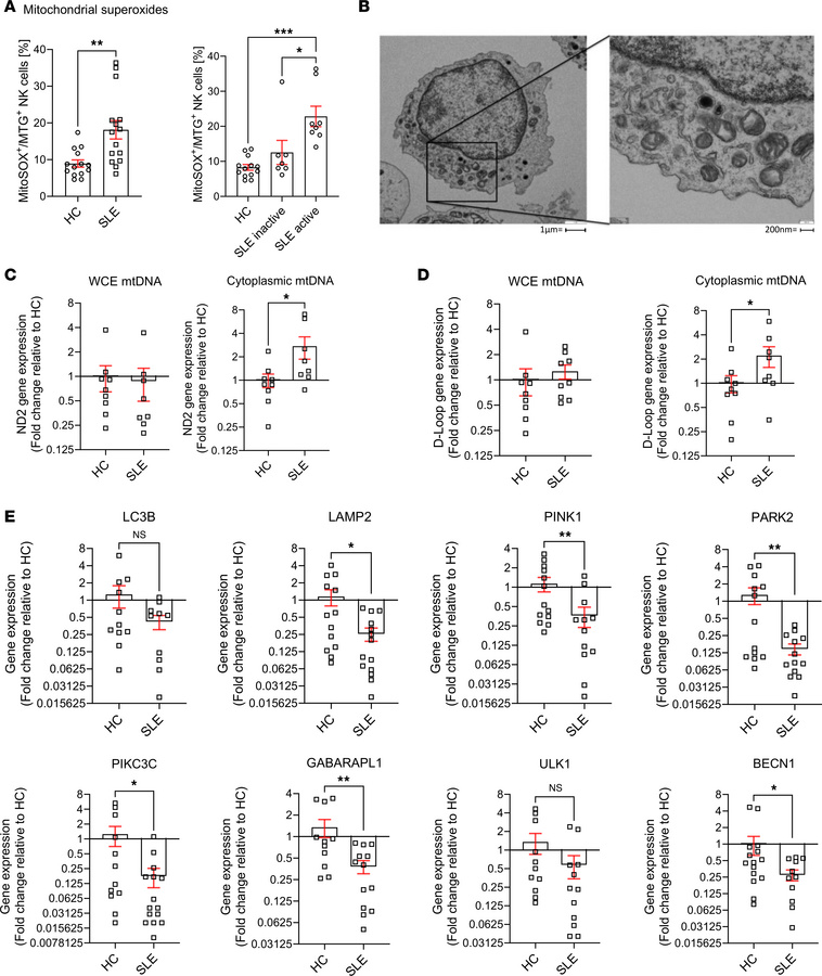 NK cells from patients with SLE harbor damaged mitochondria with disrupt...