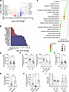 Defective lysosomal acidification drives mitochondrial dysfunction in SLE N