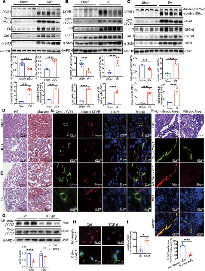 Lymphatic vessel LYVE1 shedding in three models of kidney fibrosis.
(A–C...
