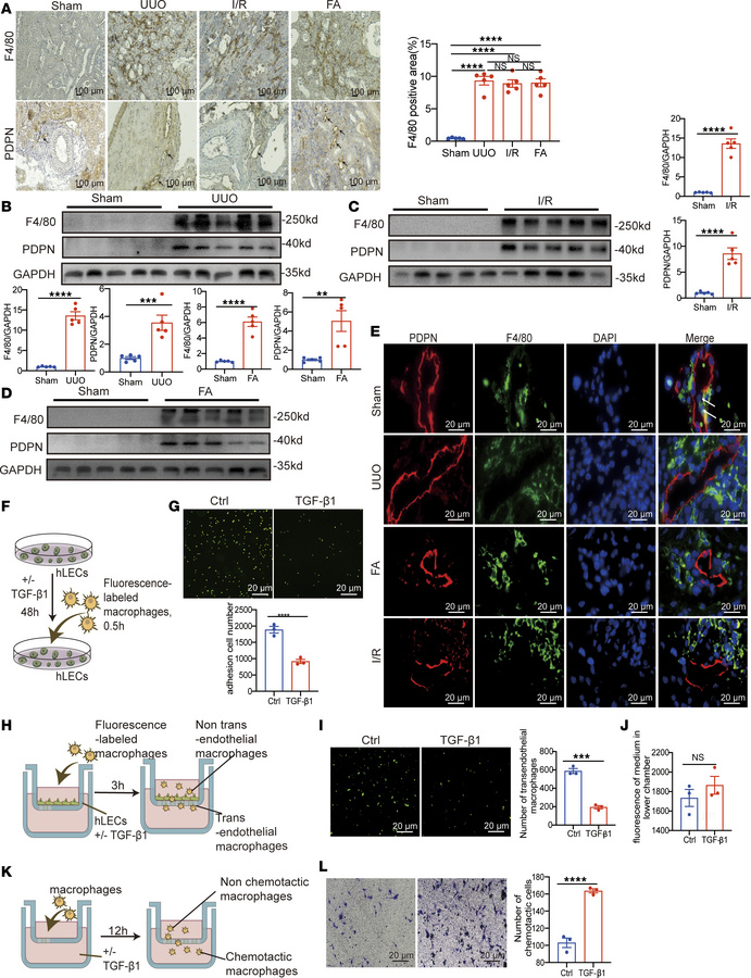 Impaired macrophage transendothelial trafficking in the fibrotic kidney....
