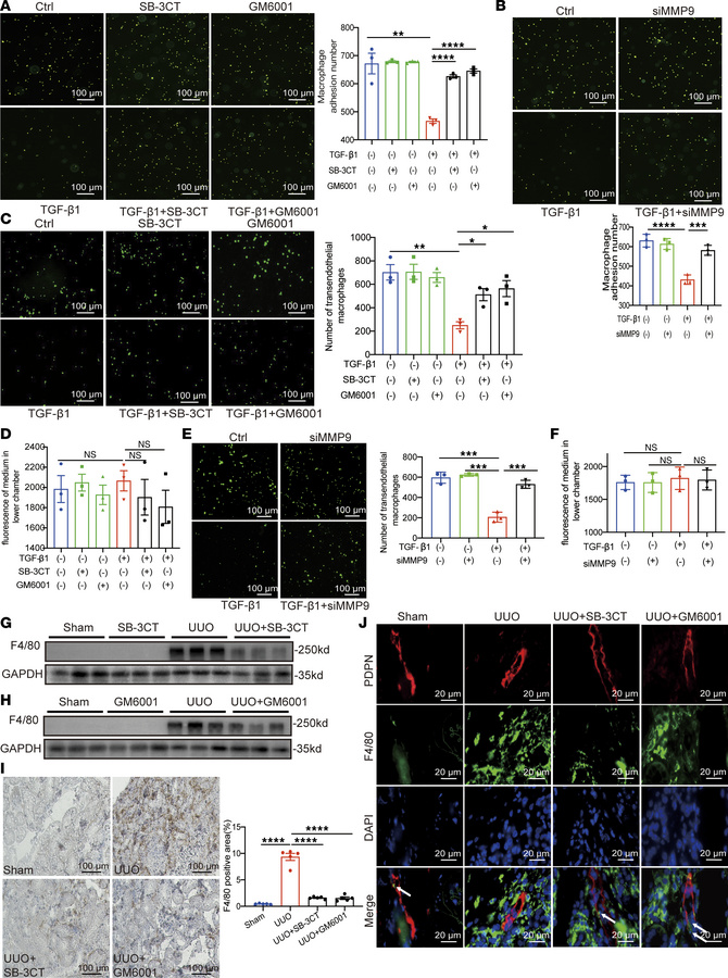 Macrophage accumulation is ameliorated by shedding inhibitors in vivo.
F...