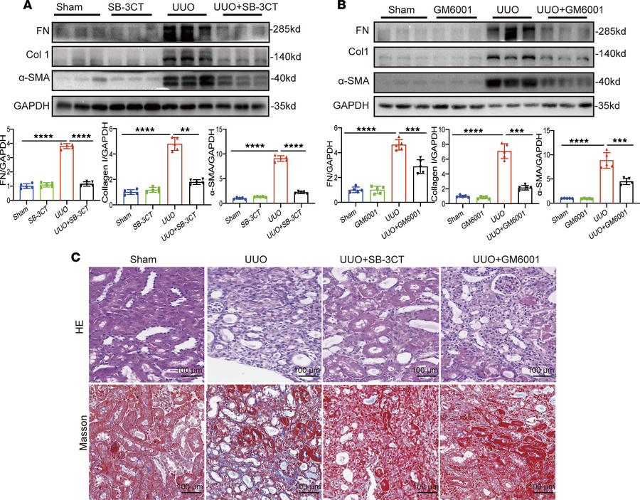 LYVE1 ectodomain shedding inhibition ameliorates renal fibrosis in vivo....
