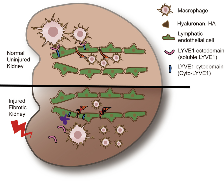 A proposed mechanism for kidney injury–driven macrophage accumulation in...