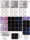 Lymphatic vessel LYVE1 shedding in three models of kidney fibrosis.