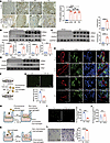 Impaired macrophage transendothelial trafficking in the fibrotic kidney.