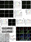 Macrophage accumulation is ameliorated by shedding inhibitors in vivo.