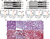 LYVE1 ectodomain shedding inhibition ameliorates renal fibrosis in vivo.