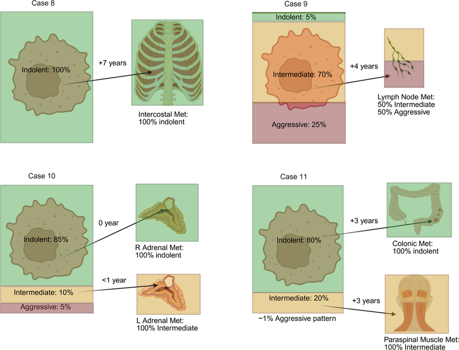 Comprehensive analyses of matched primary and nonpancreatic metastasis s...