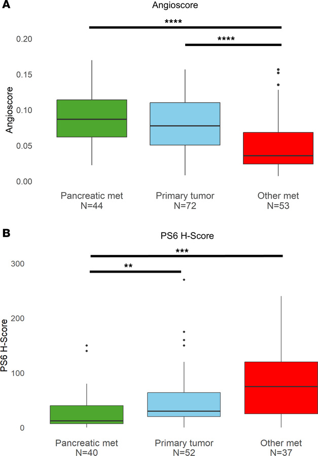 Pancreatic metastasis samples are characterized by heightened angiogenes...