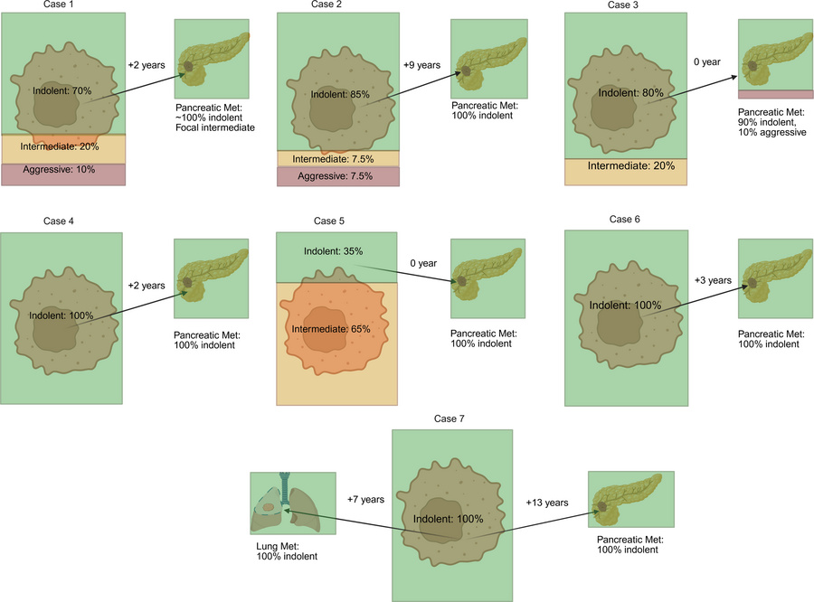 Comprehensive analyses of matched primary and pancreatic metastasis samp...
