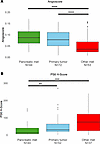 Pancreatic metastasis samples are characterized by heightened angiogenesis