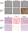 Illustrative images of pancreatic and nonpancreatic metastases.