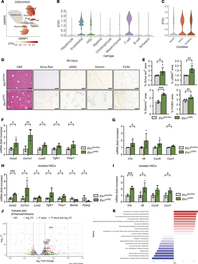 Deletion of ETS1 in HSCs promotes liver fibrosis in naive Ets1ΔHSC mice....