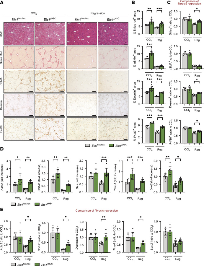 Deletion of ETS1 in HSCs exacerbates CCl4-induced liver fibrosis and pre...