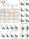 The development of liver fibrosis is increased in CCl4-injured Ets2ΔHSC mic