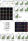 Knockdown of ETS1 in HSCs accelerates liver fibrosis in human liver spheroi