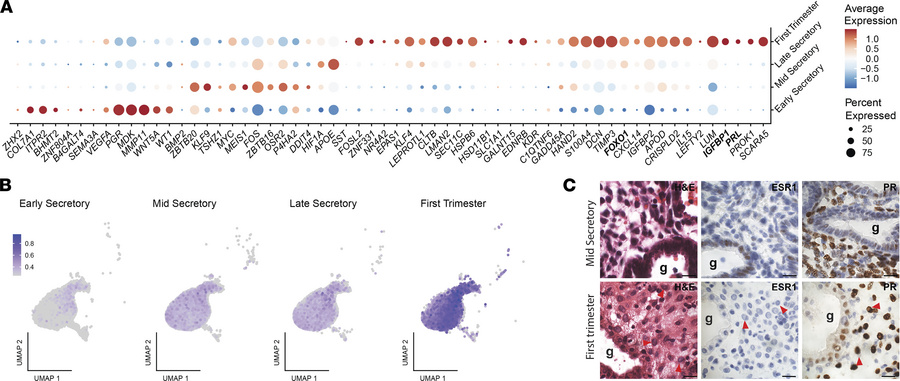 Markers of in vitro decidualization are highly expressed in endometrial ...