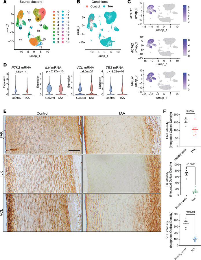 Reduced expression of key focal adhesion complex components in human tho...
