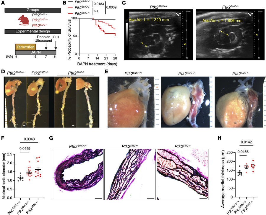 
Ptk2 deletion in SMC worsens TAA development in a gene dosage–dependent...