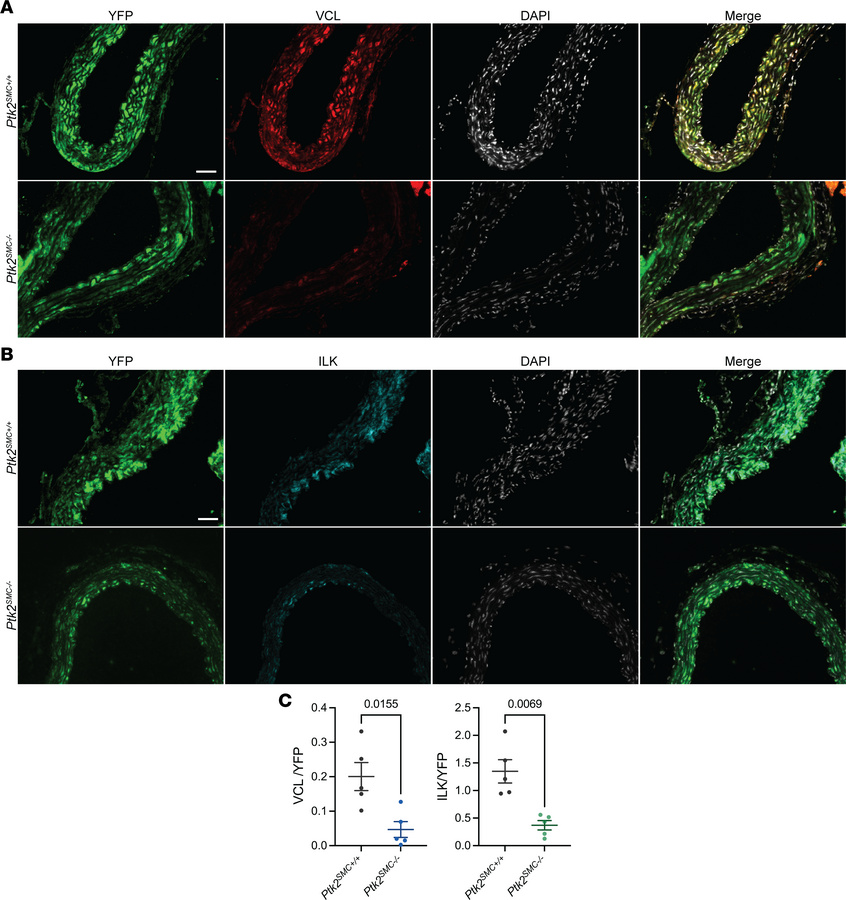 
Ptk2 deletion in SMC promotes the downregulation of VCL and ILK in vivo...