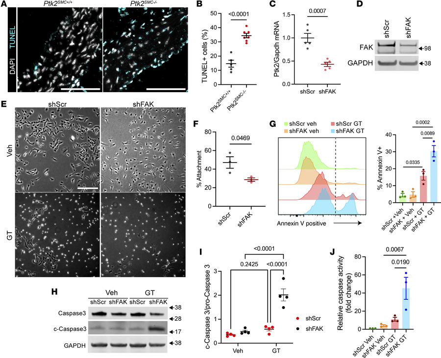 Loss of FAK expression increases SMC sensitivity to anoikis.
(A) TUNEL s...