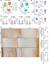 Reduced expression of key focal adhesion complex components in human thorac