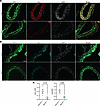 Ptk2 deletion in SMC promotes the downregulation of VCL and ILK in vivo.