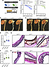 SMC-specific loss of VCL and ILK exacerbates thoracic aortic aneurysm in mi