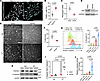 Loss of FAK expression increases SMC sensitivity to anoikis.