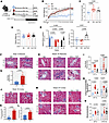 TRF reverses renal fibrosis and tubular damage in DIO mice.