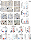 TRF reduces dark phase renal CD8+ T cells in DIO mice.