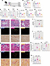 CD8+ T cell depletion in DIO mice reduces renal fibrosis and tubular damage