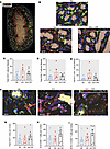 Lunaphore COMET representative images to spatially analyze PD-1+CD8+ T cell