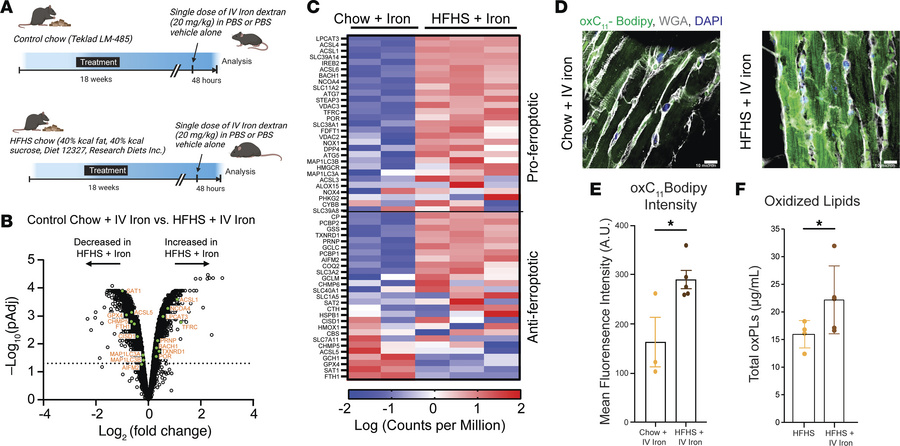 I.V. Iron induces cardiac ferroptosis in murine cardiometabolic heart fa...