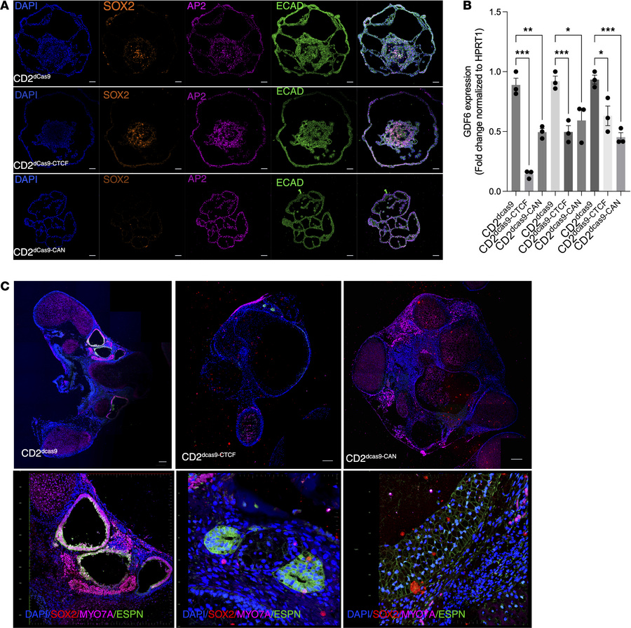 CRISPRi perturbation of a GDF6 regulatory region impairs otic epithelial...