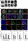 A putative GDF6 enhancer lesion impairs otic organoid development and hair