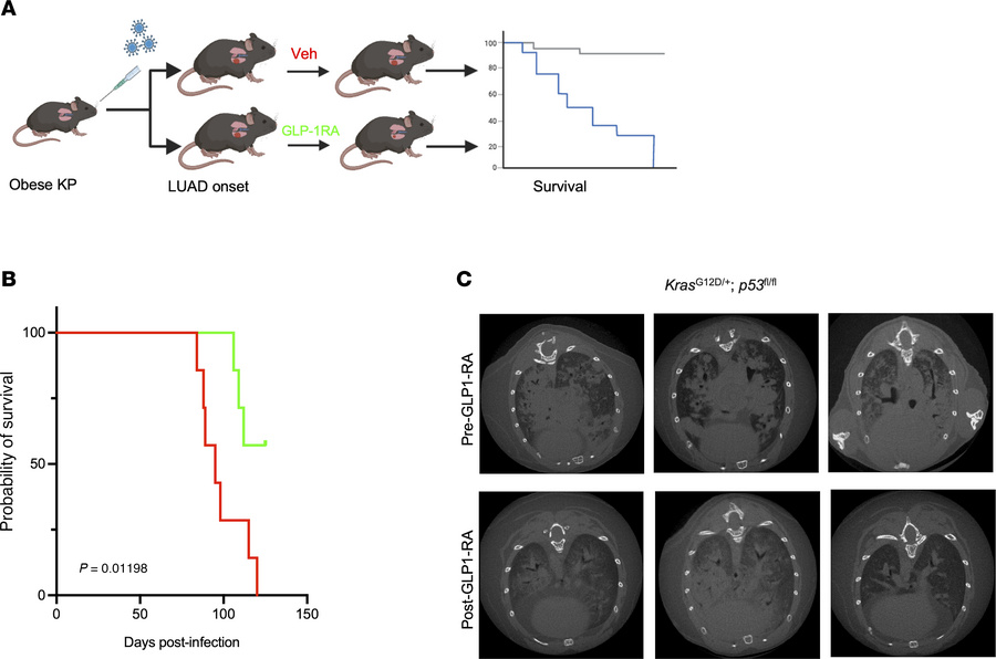 Semaglutide effect in an autochthonous mouse model.
(A) Schematic illust...