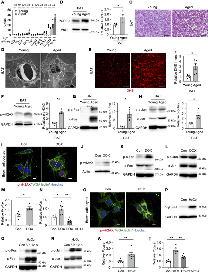 Characterization of secreted factors from BAT.
BAT from C57BL/6NCrSlc mi...