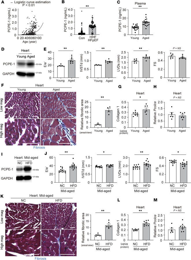HFpEF models exhibit high PCPE-1 level in hearts.
(A and B) Plasma PCPE-...