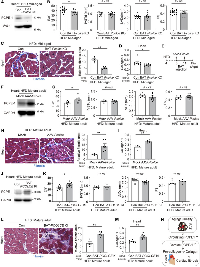 The BATokine PCPE-1 contributes to the pathogenesis of HFpEF.
Littermate...