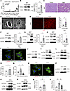 Characterization of secreted factors from BAT.