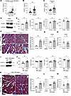 HFpEF models exhibit high PCPE-1 level in hearts.