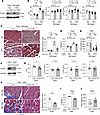 Depletion of PCPE-1 ameliorates HFpEF in obesity and aged mouse models.