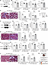 The BATokine PCPE-1 contributes to the pathogenesis of HFpEF.