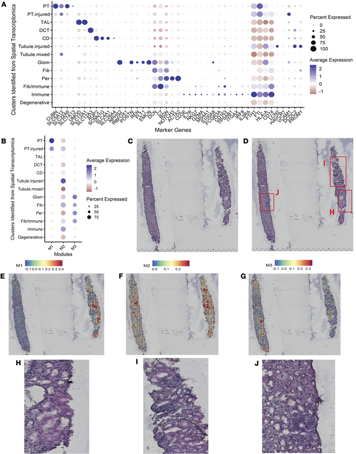 Urinary proteins associated with longitudinal eGFR decline are associate...